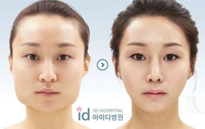 Before and After Plastic Surgery (29 pics)