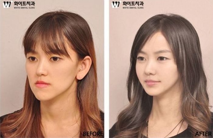 Before and After Plastic Surgery (29 pics)