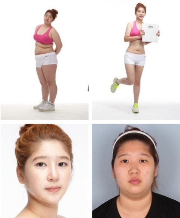 Before and After Plastic Surgery (29 pics)