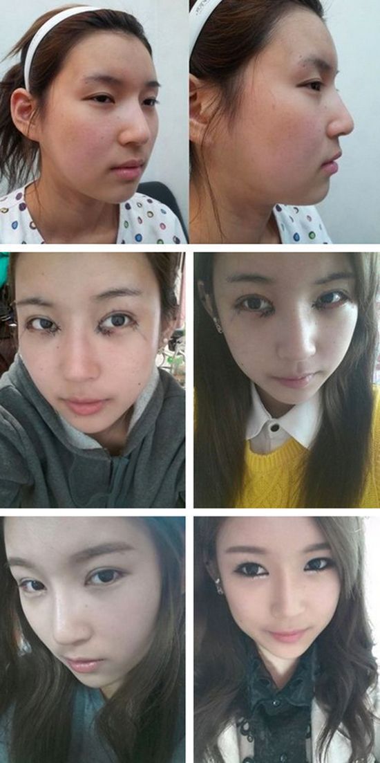 Before and After Plastic Surgery (29 pics)