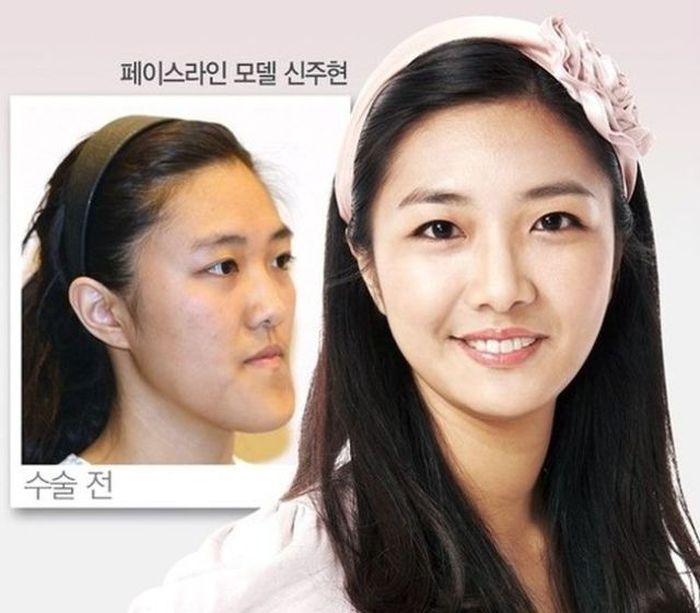 Before and After Plastic Surgery (29 pics)