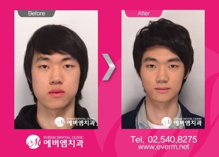 Before and After Plastic Surgery (29 pics)