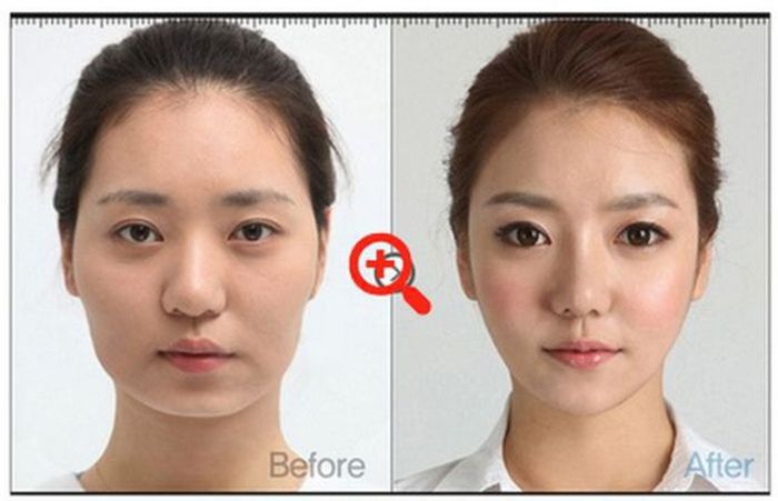 Before and After Plastic Surgery (29 pics)