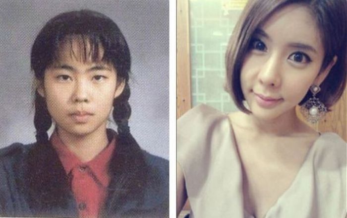 Before and After Plastic Surgery (29 pics)