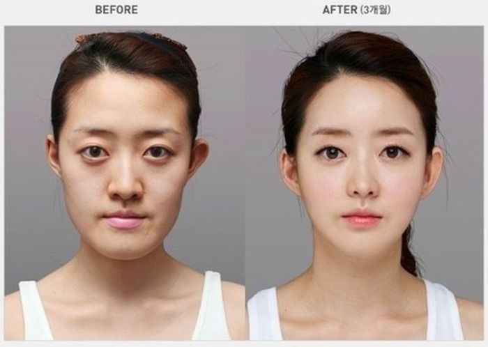 Before and After Plastic Surgery (29 pics)