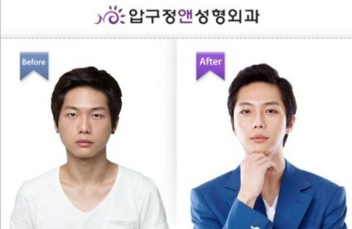 Before and After Plastic Surgery (29 pics)