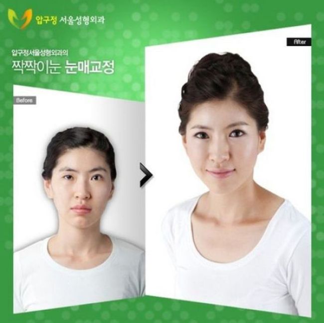 Before and After Plastic Surgery (29 pics)