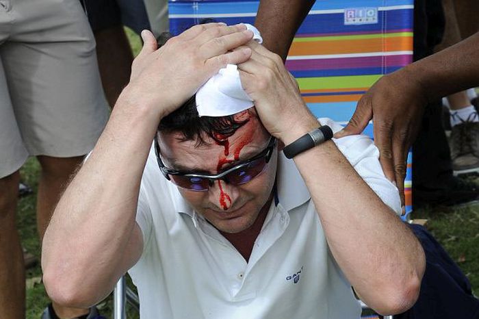 Tiger Woods Hits Fan in Head (5 pics)
