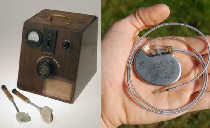 How Medical Technology Has Changed Over the Years (13 pics)