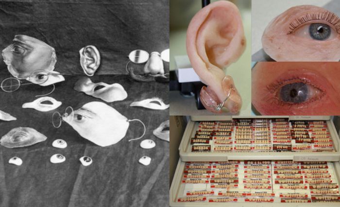 How Medical Technology Has Changed Over the Years (13 pics)