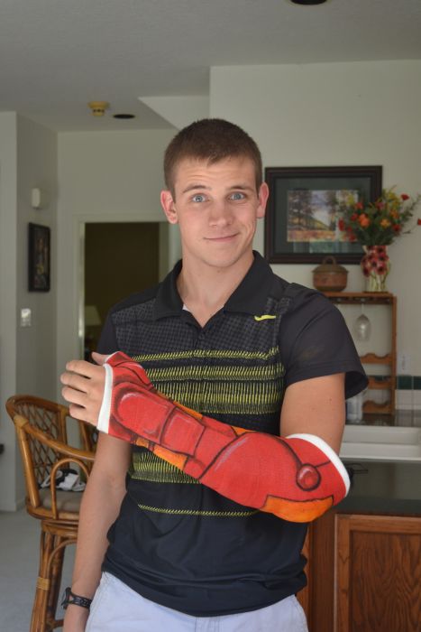 How to Wear a Cast in the Right Way (9 pics)