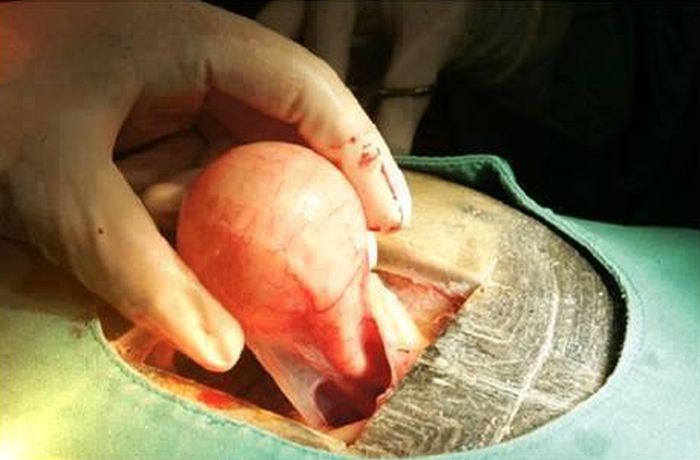 Caesarean Section for a Turtle (6 pics)