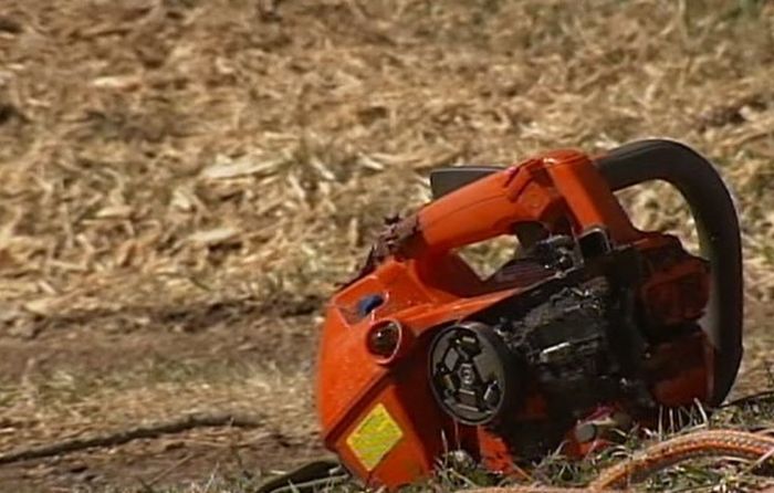 Chainsaw Stuck in Neck (6 pics)