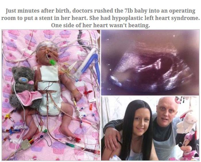 This Baby Became a Miracle (3 pics)