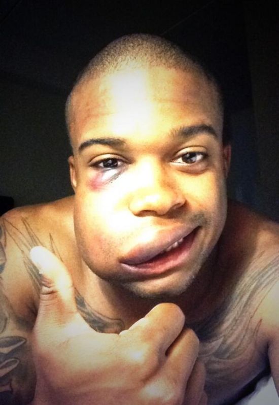MLB Player Delino DeShields Jr Gets Hit in the Face (2 pics)