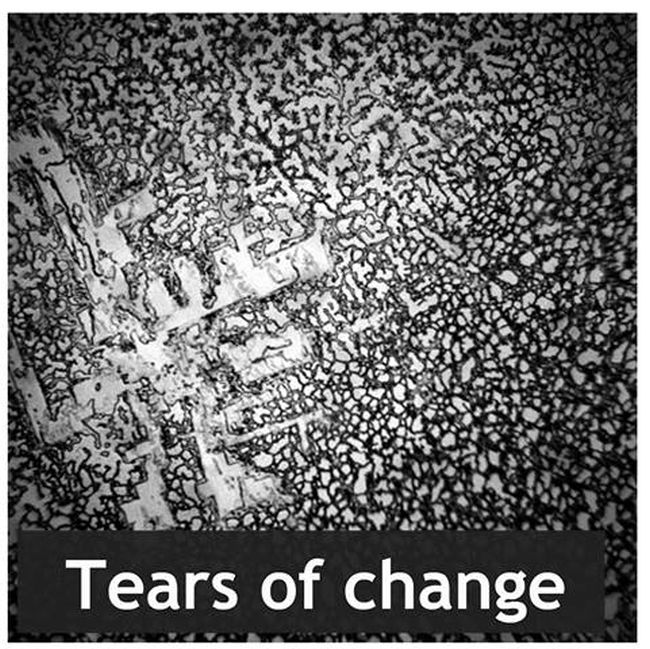 This Is What Dried Human Tears Look Like (5 pics)