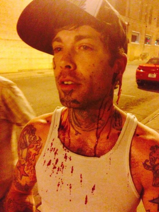 Guy Gets Ear Gauges Ripped Out In Street Fight (2 pics)