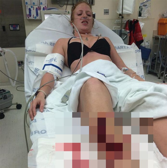Florida Woman Bit By Shark, No Big Deal (5 pics)