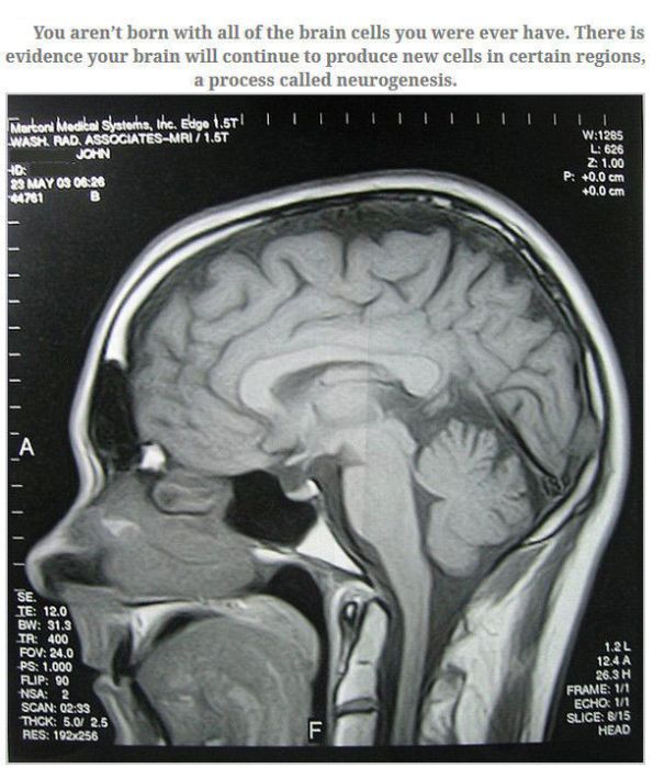 Feed Your Brain With These Awesome Facts (35 pics)