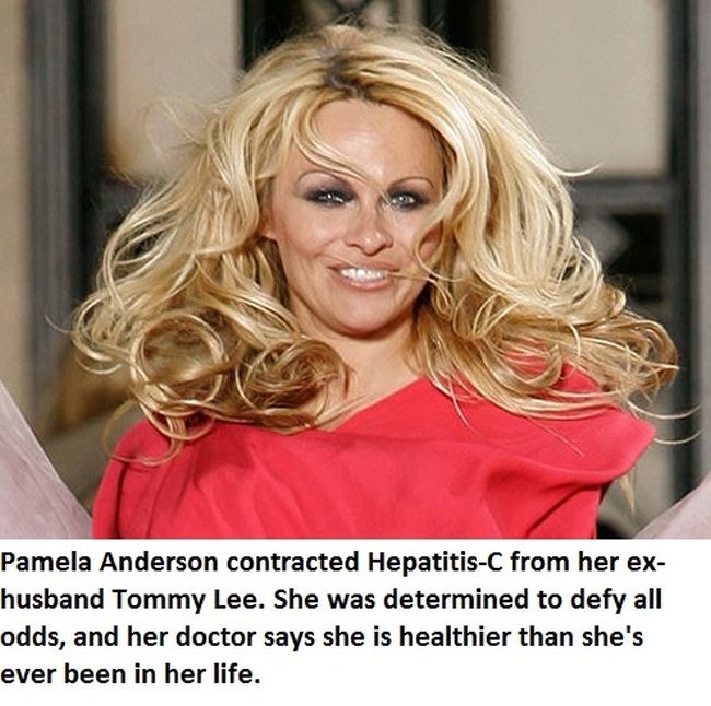 Celebrities You Didn't Know Have STDs (15 pics)