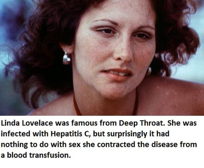 Celebrities You Didn't Know Have STDs (15 pics)