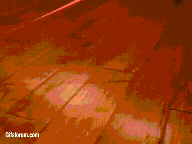 Acid Gifdump, June 09, 2014 (25 gifs)