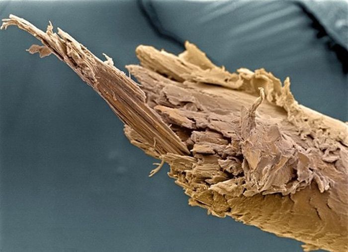 Random Things Through An Electron Microscope (21 pics)