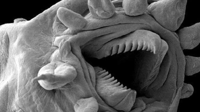 Random Things Through An Electron Microscope (21 pics)