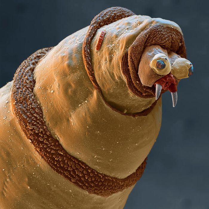 Random Things Through An Electron Microscope (21 pics)