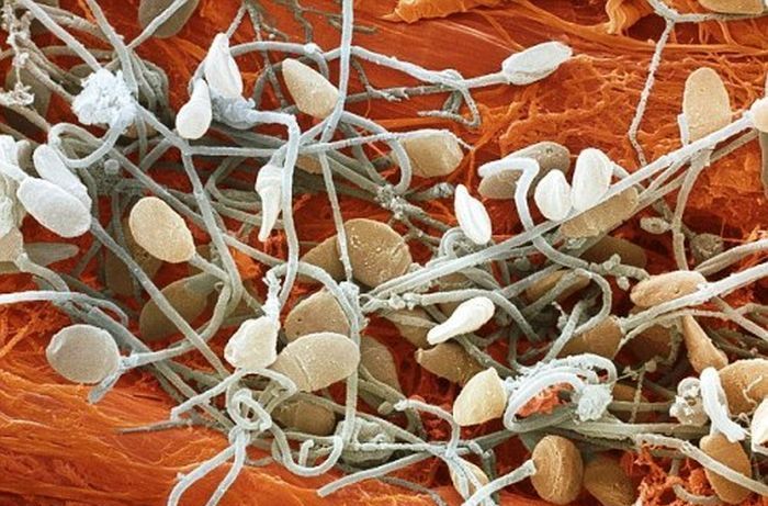 Random Things Through An Electron Microscope (21 pics)