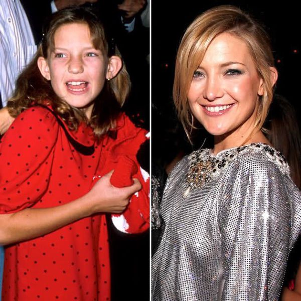 Photos Of Famous Celebrities From Their Younger Days (93 pics)