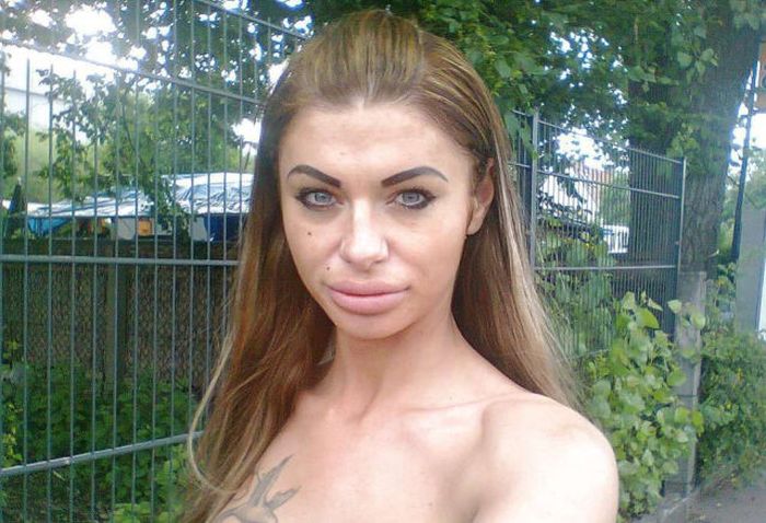 Plastic Surgery Gone Wrong (25 pics)