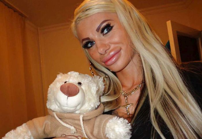 Plastic Surgery Gone Wrong (25 pics)