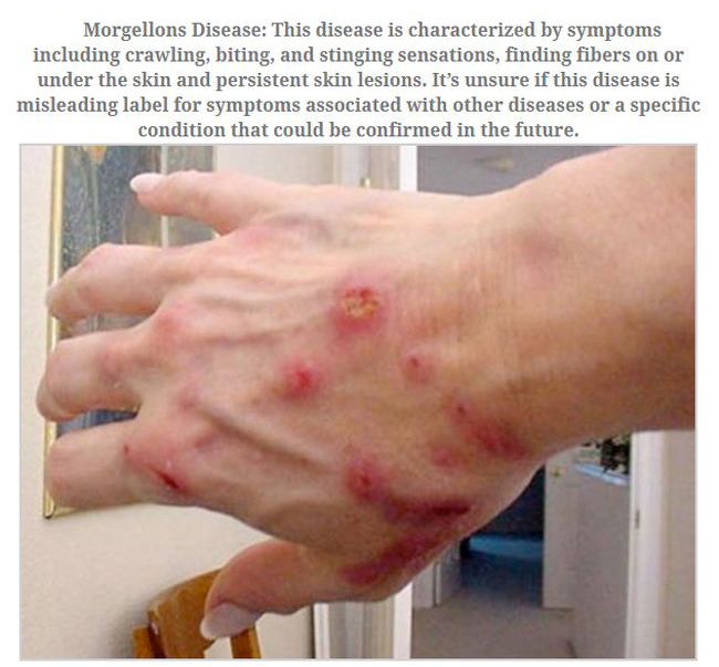 No One Knows How To Stop These Diseases (10 pics)