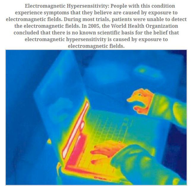 No One Knows How To Stop These Diseases (10 pics)