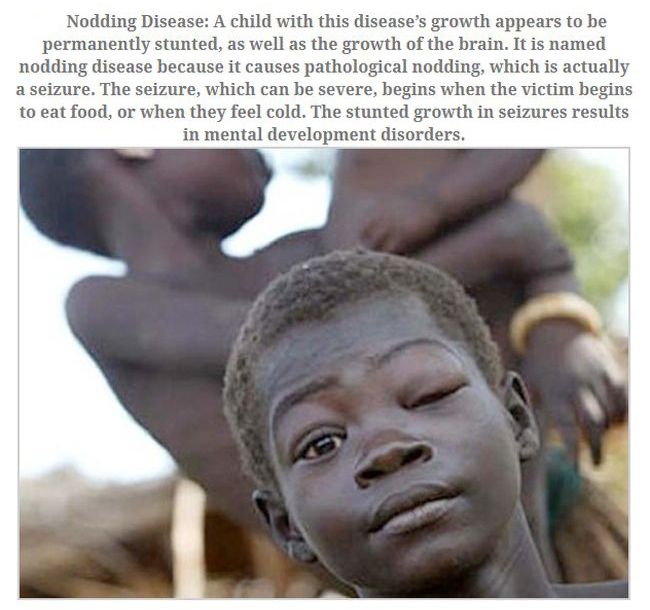 No One Knows How To Stop These Diseases (10 pics)
