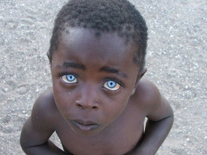 You Can Learn So Much From Someone's Eyes (21 pics)