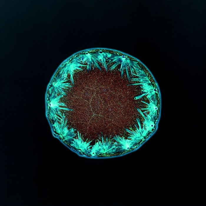 Drugs Look A Lot Different Under A Microscope (16 pics)