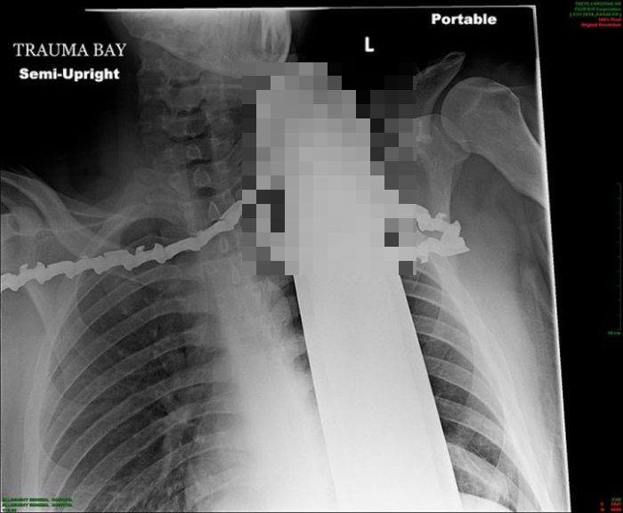 The Most Ridiculous X-Rays You'll Ever See (22 pics)