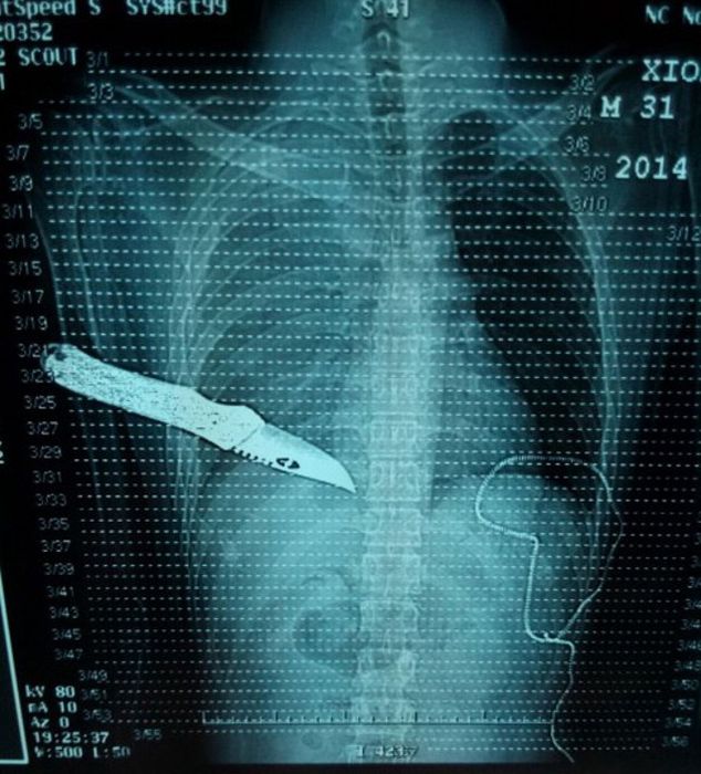 The Most Ridiculous X-Rays You'll Ever See (22 pics)