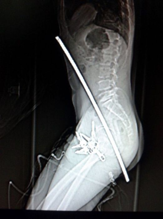 The Most Ridiculous X-Rays You'll Ever See (22 pics)