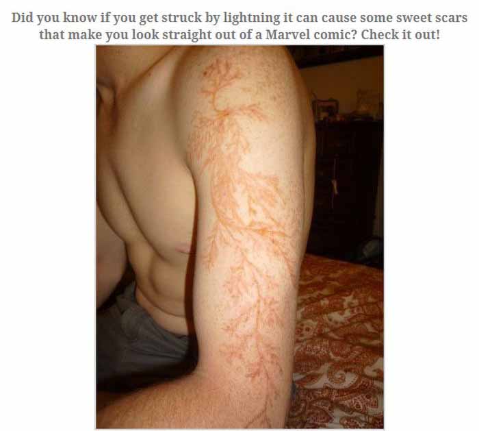 This Is What Happens When You Get Struck By Lightning (13 pics)