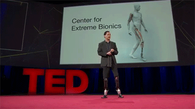 Prosthetic Limbs Prove The Future Is Now (7 gifs)