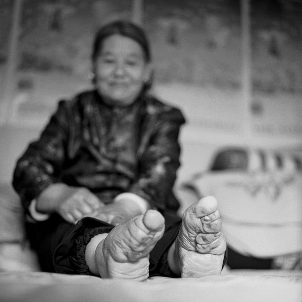 Foot Binding In China Is Coming To An End (12 pics)