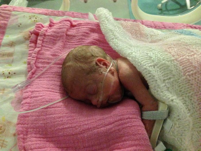 Baby Is Born 16 Weeks Early (84 pics)