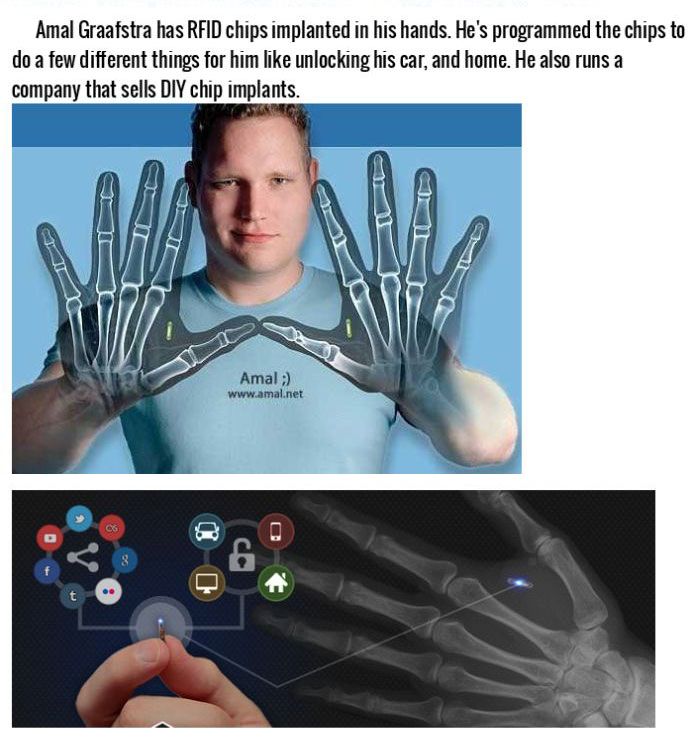 Real Life Cyborgs Living In The World Today (6 pics + 5 video)