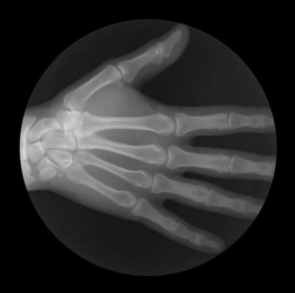 X-Ray GIFs That Show How Your Skeleton Works (5 gifs)