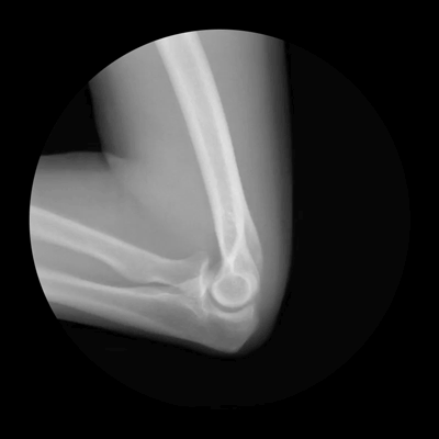 X-Ray GIFs That Show How Your Skeleton Works (5 gifs)