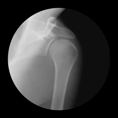 X-Ray GIFs That Show How Your Skeleton Works (5 gifs)