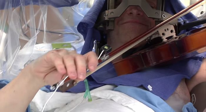 Man Plays Violin During His Own Brain Surgery (10 pics)